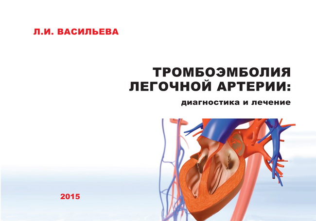 Тромбоэмболия легочной артерии. Книга 1. Диагностика и лечение