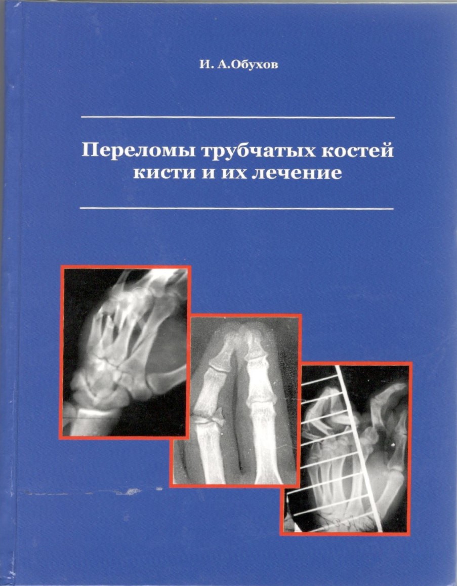 Кистевая хирургия. Т.1. Переломы трубчатых костей кисти и их лечение