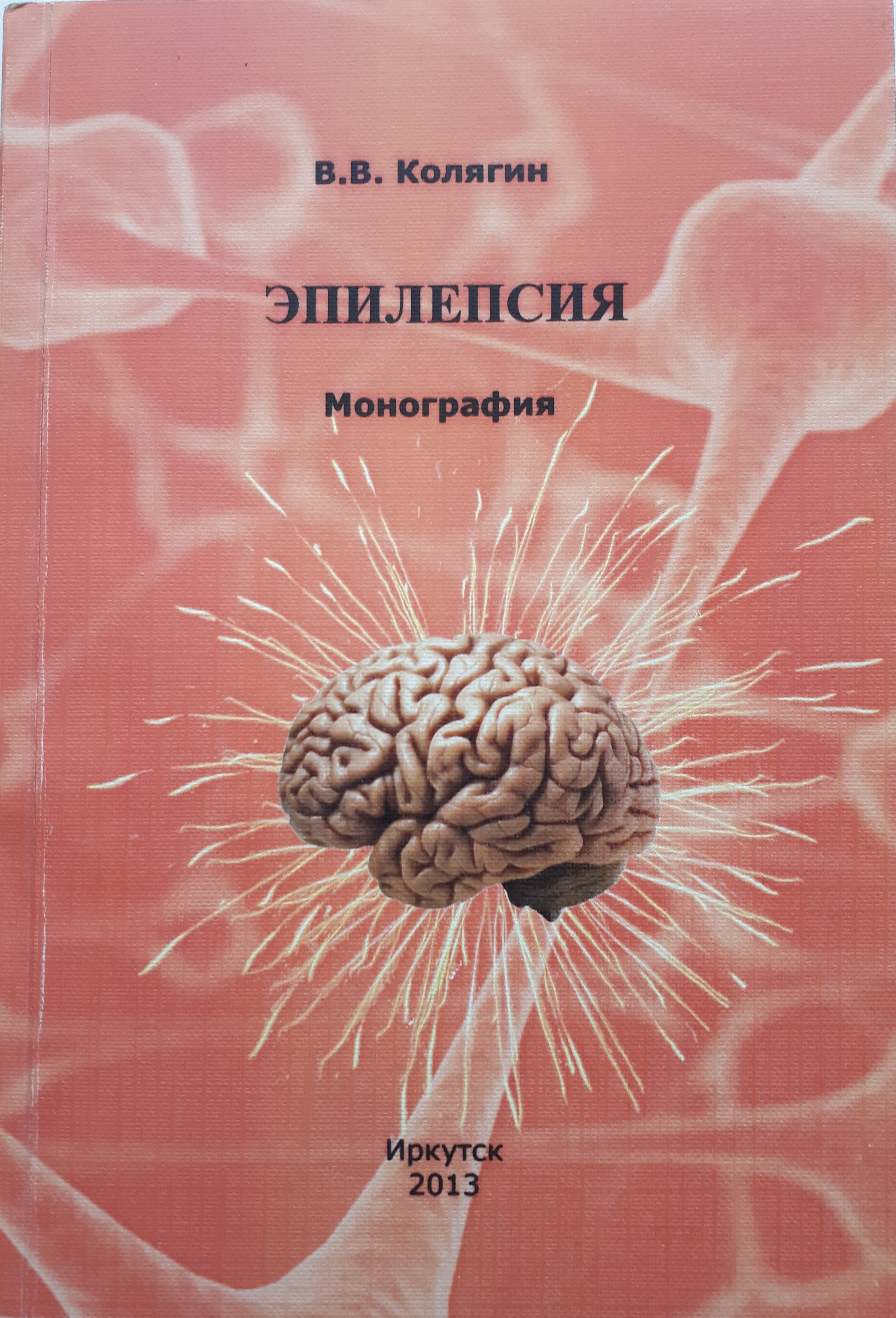 Эпилепсия