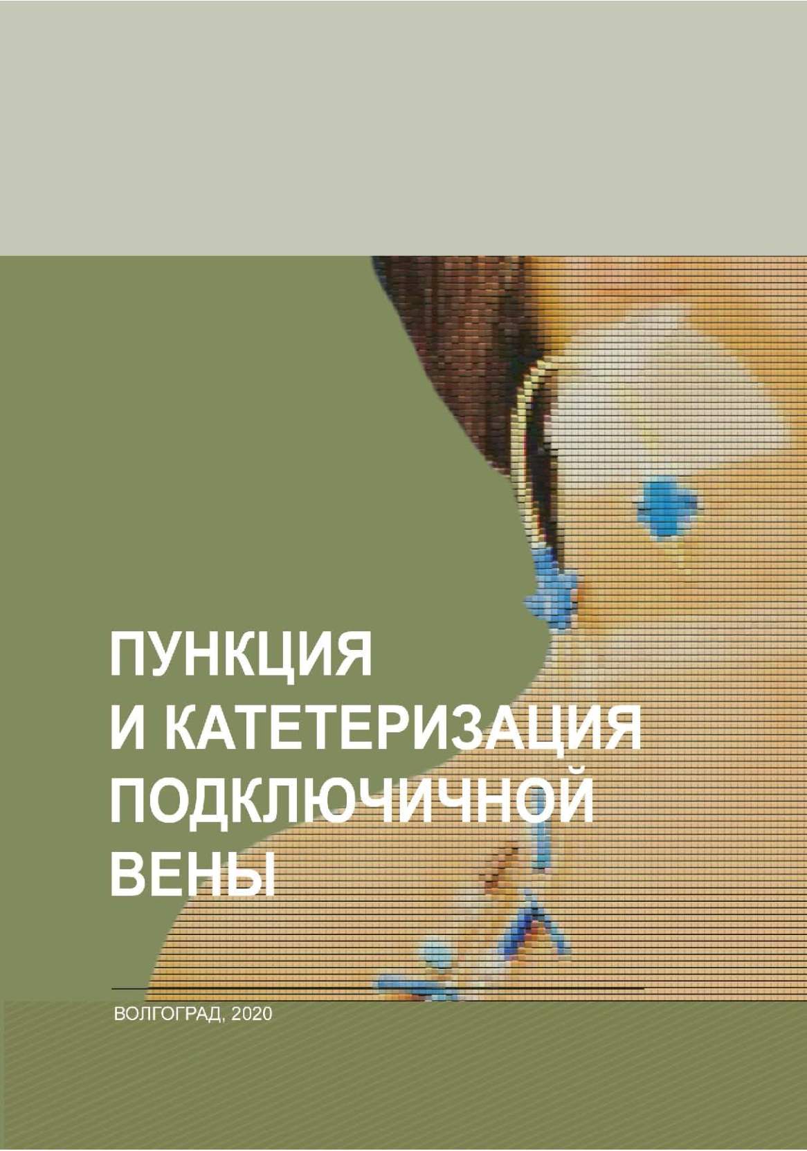 Для профилактики воздушной эмболии при катетеризации подключичной вены обязательно положение кровати