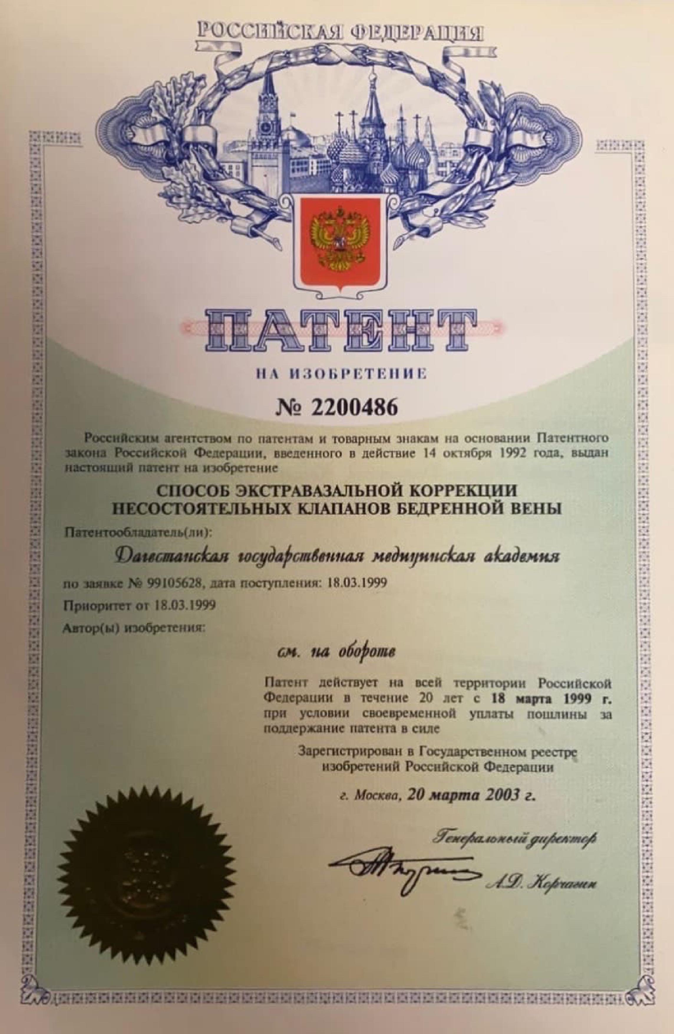 СПОСОБ ЭКСТРАВАЗАЛЬНОЙ КОРРЕКЦИИ НЕСОСТОЯТЕЛЬНЫХ КЛАПАНОВ БЕДРЕННОЙ ВЕНЫ