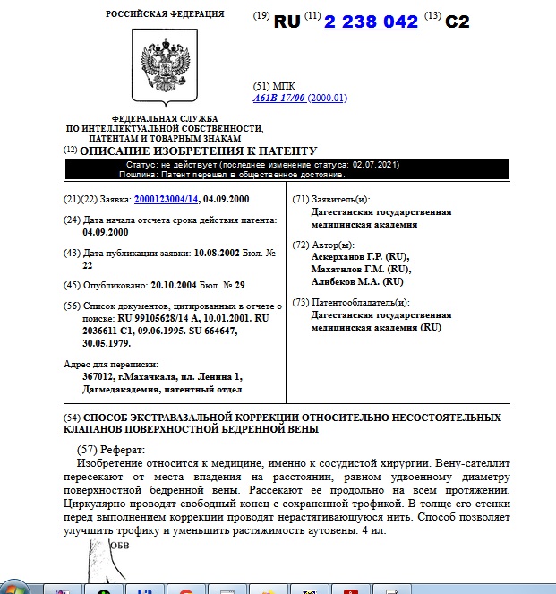 СПОСОБ ЭКСТРАВАЗАЛЬНОЙ КОРРЕКЦИИ ОТНОСИТЕЛЬНО НЕСОСТОЯТЕЛЬНЫХ КЛАПАНОВ ПОВЕРХНОСТНОЙ БЕДРЕННОЙ ВЕНЫ